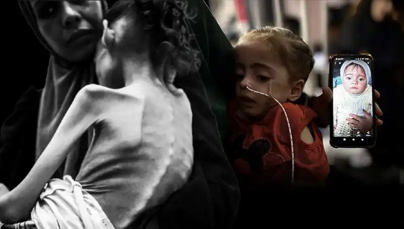 Küçük Meryem'in Açlıkla Mücadelesi: 25 Kilodan 10 Kiloya Düşüşü