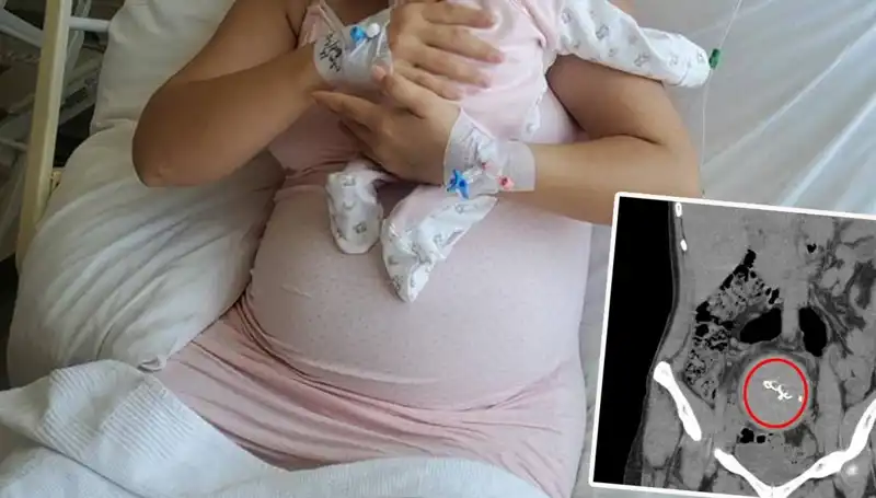 Doğumda Unutulan Bebeğin İhmaline Soruşturma Açıldı: Gazlı Bez Skandalı